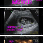 Baby Update: Week 11