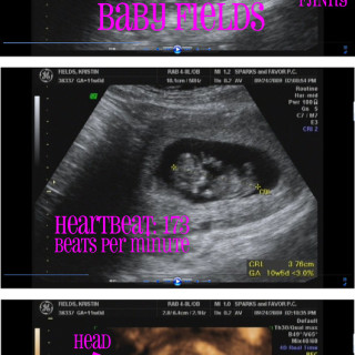 Baby Update: Week 11